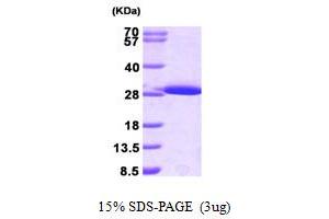 SDS-PAGE (SDS) image for Glutathione S-Transferase mu 1 (GSTM1) (AA 1-218) protein (His tag) (ABIN666904) (GSTM1 Protein (AA 1-218) (His tag))
