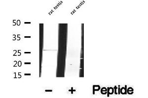 Western blot analysis of extracts of rat testis tissue, using DCTN6 antibody.
