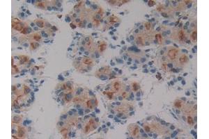 IHC-P analysis of Human Stomach Tissue, with DAB staining. (SIRPB1 anticorps  (AA 127-356))