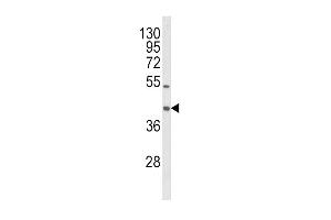 Western blot analysis of OLR1 Antibody (Center) (ABIN652795 and ABIN2842521) in HL-60 cell line lysates (35 μg/lane). (OLR1 anticorps  (AA 64-92))