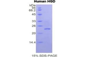 SDS-PAGE analysis of Human HGD Protein. (HGD Protéine)