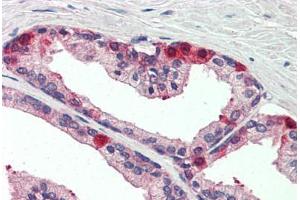 Human Prostate (formalin-fixed, paraffin-embedded) stained with TAOK3 antibody ABIN337220 at 1:5 followed by biotinylated anti-goat IgG secondary antibody ABIN481715, alkaline phosphatase-streptavidin and chromogen. (TAO Kinase 3 anticorps  (AA 396-411))