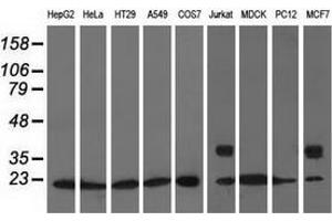Western blot analysis of extracts (35 µg) from 9 different cell lines by using anti-ARHGDIA monoclonal antibody.