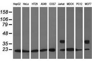 Western blot analysis of extracts (35 µg) from 9 different cell lines by using anti-ARHGDIA monoclonal antibody. (ARHGDIA anticorps)