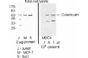Image no. 1 for anti-Calreticulin (CALR) (C-Term) antibody (ABIN265295) (Calreticulin anticorps  (C-Term))
