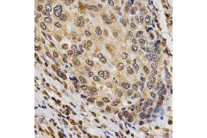 Immunohistochemistry (IHC) image for anti-Histone H3 (H3) (H3K9me3) antibody (ABIN3016030) (Histone 3 anticorps  (H3K9me3))