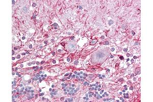 Anti-RP2 antibody IHC of human brain, cerebellum.