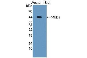 Detection of Recombinant STS, Human using Polyclonal Antibody to Steroid Sulfatase Isozyme S (STS) (STS anticorps  (AA 235-583))