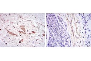 Immunohistochemical analysis of paraffin-embedded brain tissues (left) and esophageal cancer tissues (right) using HSP27 mouse mAb with DAB staining.
