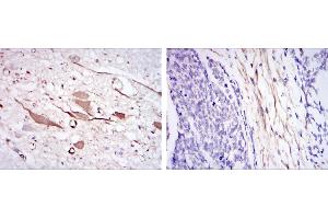 Immunohistochemical analysis of paraffin-embedded brain tissues (left) and esophageal cancer tissues (right) using HSP27 mouse mAb with DAB staining.