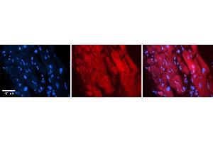 Rabbit Anti-ZFR Antibody    Formalin Fixed Paraffin Embedded Tissue: Human Adult heart  Observed Staining: Cytoplasmic Primary Antibody Concentration: 1:600 Secondary Antibody: Donkey anti-Rabbit-Cy2/3 Secondary Antibody Concentration: 1:200 Magnification: 20X Exposure Time: 0.