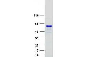 Validation with Western Blot