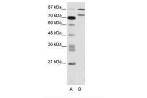 Image no. 1 for anti-Zinc Finger Protein 709 (ZNF709) (AA 61-110) antibody (ABIN202844) (ZNF709 anticorps  (AA 61-110))