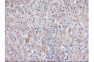 Immunohistochemical staining of paraffin-embedded Human liver tissue using anti-BTK mouse monoclonal antibody. (BTK anticorps)