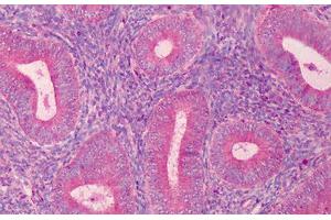 Human Endometrium: Formalin-Fixed, Paraffin-Embedded (FFPE) (PAK2 anticorps  (C-Term))