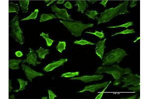 Immunofluorescence of monoclonal antibody to PCTK1 on HeLa cell.