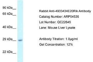 Western Blotting (WB) image for anti-RIKEN CDNA 4933434E20 Gene (4933434E20RIK) (N-Term) antibody (ABIN2774077) (4933434E20Rik anticorps  (N-Term))