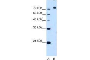 Western Blotting (WB) image for anti-Corin, Serine Peptidase (CORIN) antibody (ABIN2463005) (Corin anticorps)