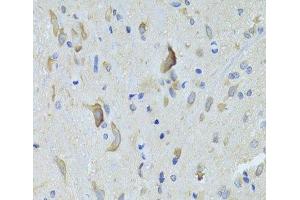 Immunohistochemistry of paraffin-embedded Rat spinal cord using SARS Polyclonal Antibody at dilution of 1:100 (40x lens). (Seryl-tRNA Synthetase (SARS) anticorps)