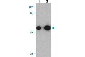 Western blot analysis of KREMEN1 in rat small intestine tissue with KREMEN1 polyclonal antibody  at (lane 1) 0.