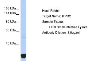 Host: Rabbit Target Name: ITPR2 Sample Type: Fetal Small Intestine lysates Antibody Dilution: 1. (ITPR2 anticorps  (N-Term))