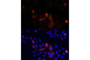 Immunofluorescence analysis of HeLa cells using MT-ND2 antibody (ABIN7268600) at dilution of 1:100. (MT-ND2 anticorps  (C-Term))