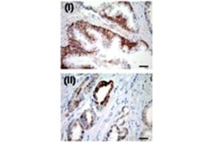 IHC for USP2a in a formalin-fixed, paraffin-embedded human prostate sample.
