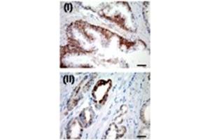 IHC for USP2a in a formalin-fixed, paraffin-embedded human prostate sample. (USP2 anticorps  (N-Term))