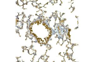 Immunohistochemistry of paraffin-embedded mouse lung using IFIH1 Rabbit pAb (ABIN6131879, ABIN6142174, ABIN6142175 and ABIN6217724) at dilution of 1:50 (40x lens).