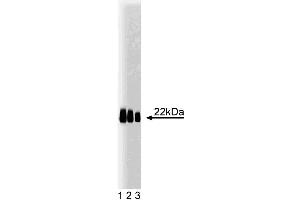 Western blot analysis of Caveolin 1. (Caveolin-1 anticorps  (AA 1-178))