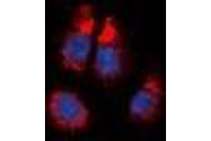 Immunofluorescent analysis of Alpha-1A Adrenergic Receptor staining in NIH3T3 cells. (alpha 1 Adrenergic Receptor anticorps  (C-Term))
