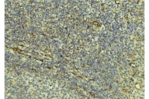 ABIN6276540 at 1/100 staining Human lymph tissue by IHC-P. (DcR1 anticorps)