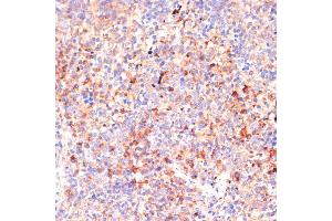 Immunohistochemistry of paraffin-embedded mouse spleen using IL4R antibody (ABIN7268001) at dilution of 1:100 (40x lens). (IL4 Receptor anticorps  (AA 26-232))
