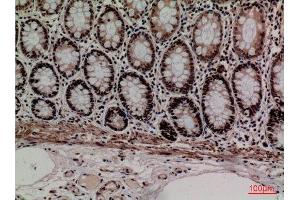 Immunohistochemistry (IHC) analysis of paraffin-embedded Human Colon, antibody was diluted at 1:100. (MCM3 anticorps  (Internal Region))