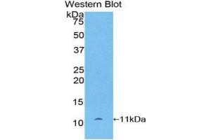 Western Blotting (WB) image for anti-Pro-Platelet Basic Protein (Chemokine (C-X-C Motif) Ligand 7) (PPBP) (AA 46-107) antibody (ABIN1077858) (CXCL7 anticorps  (AA 46-107))