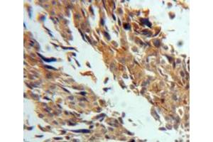 IHC-P analysis of ovary tissue, with DAB staining. (TGM3 anticorps  (AA 468-693))