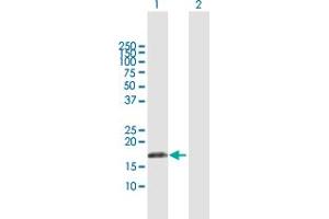 Western Blot analysis of IFNA17 expression in transfected 293T cell line by IFNA17 MaxPab polyclonal antibody. (IFNA17 anticorps  (AA 1-189))