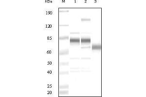 Western blot analysis using anti-KSHV ORF8 polyclonal antiobdy against uninduced BCBL1 cell lysate (1), TPA induced BCBL1 cell lysate(2) and purified virion (3). (KSHV ORF8 anticorps)