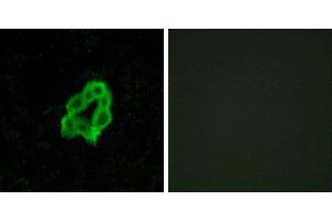 Peptide - +Immunofluorescence analysis of MCF-7 cells, using BAI1 antibody. (BAI1 anticorps  (Internal Region))