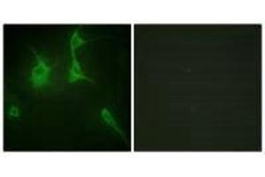Immunofluorescence analysis of NIH/3T3 cells, using Collagen IX α3 antibody. (COL9A3 anticorps)