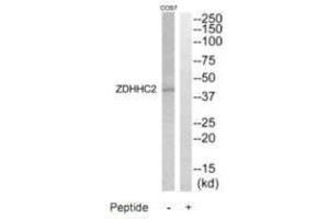 Western blot analysis of extracts from COS7 cells, using ZDHHC2 antibody. (ZDHHC2 anticorps)