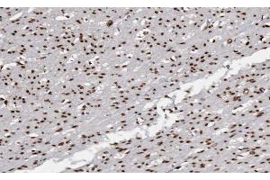 ABIN6266672 at 1/100 staining human Smooth muscle tissue sections by IHC-P. (USF2 anticorps  (Internal Region))