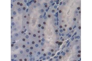 Used in DAB staining on fromalin fixed paraffin- embedded Kidney tissue