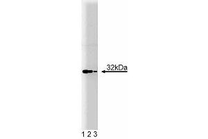 Western blot analysis of Heme Oxygenase 1 on SW13 lysate.