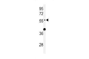 Western blot analysis of ATL3 Antibody (Center) (ABIN650914 and ABIN2839992) in mouse liver tissue lysates (35 μg/lane). (ATL3 anticorps  (AA 217-245))