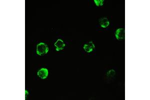 IHC analysis of Cyclophilin A using anti-Cyclophilin A antibody .
