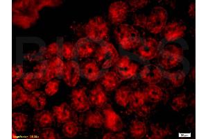 Formalin-fixed and paraffin-embedded mouse intestine labeled with Anti-CD33/Siglec-3 Polyclonal Antibody, Unconjugated (ABIN687607) 1:200, overnight at 4°C, The secondary antibody was Goat Anti-Rabbit IgG, Cy3 conjugated used at 1:200 dilution for 40 minutes at 37°C.