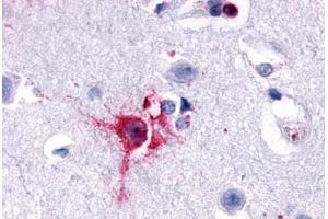 Anti-Delta Opioid Receptor antibody  ABIN1048495 IHC staining of human brain, neurons and glia. (OPRD1 anticorps  (N-Term))
