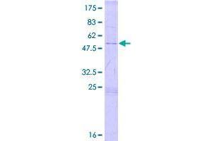 TSPY-Like 4 (TSPYL4) (AA 1-211) protein (GST tag)