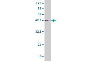 Western Blot detection against Immunogen (36. (FOXD1 anticorps  (AA 1-91))